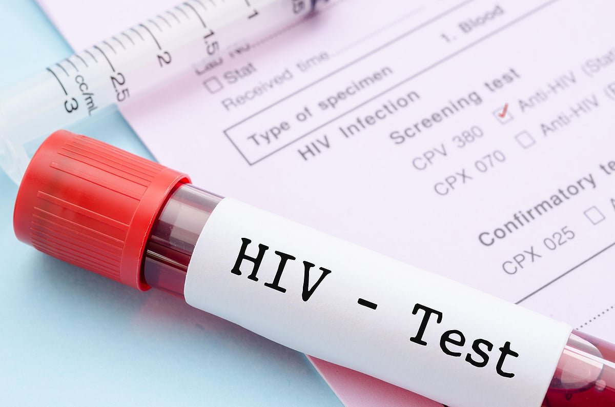 Four New HIV Cases Recorded As Officials Identify Interconnected Sexual Networks